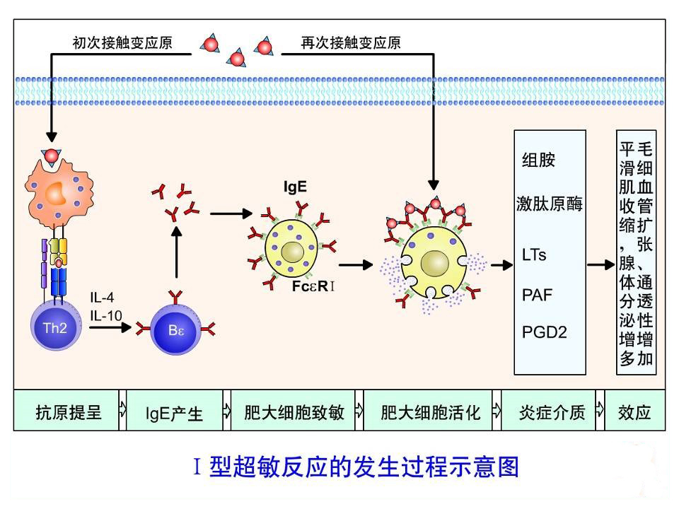 过敏性哮喘是什么原因产生的