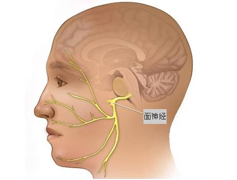 神经外科专家告诉您 面肌痉挛是否能自愈?!