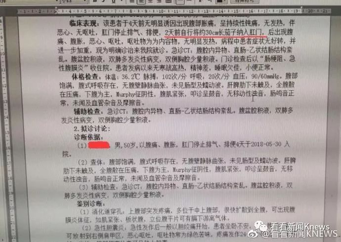 腹痛便秘竟将30厘米长的茄子塞入体内,都快顶到心脏了