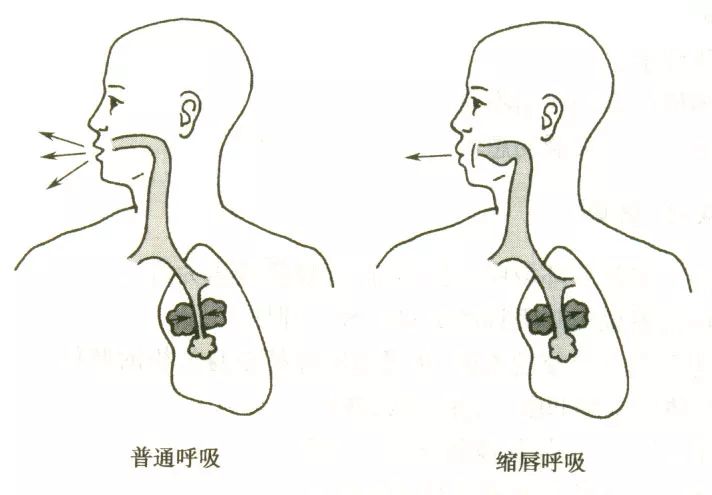 云呼是什么原理(2)