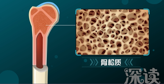 深读骨质疏松2燃爆烧脑解析骨质疏松