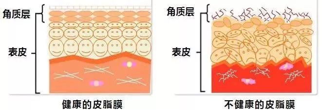 但是油脂分泌旺盛,不代表皮肤屏障健康.