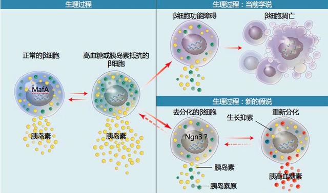 病例分享|体型超重的初发2型糖尿病,胰岛功能保护至关重要!