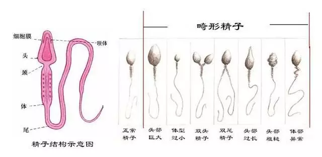 手把手教你看懂检查报告——精液常规