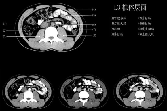 经典1小时读懂腹部ct