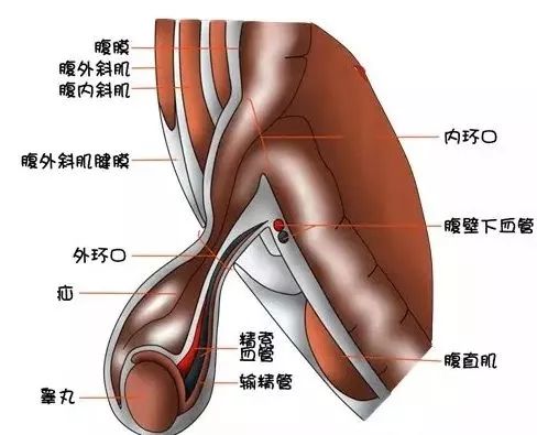小儿疝俗称 "小肠气",是小儿普通外科手术中最常见的疾病,在胚胎时期