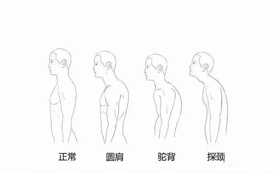 vita少年瑜伽形体矫正课来啦!改善您孩子的肥胖,驼背,o型腿