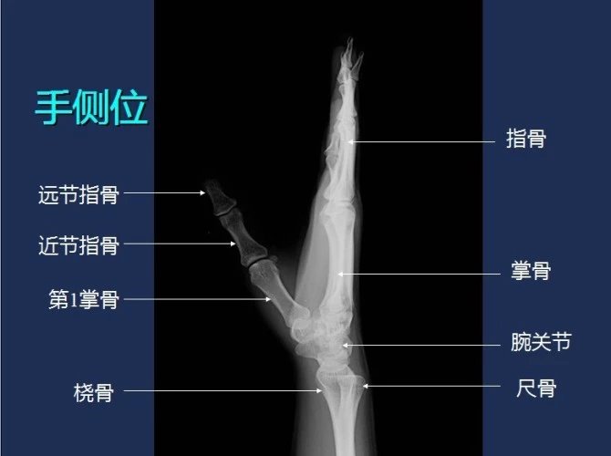 常规x线影像解剖大全