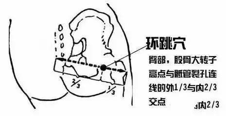 环跳穴 位置:股骨大转子和骶管裂孔连线的外三分之一处.