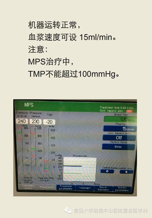 图解血浆置换全过程一步步来准保学会