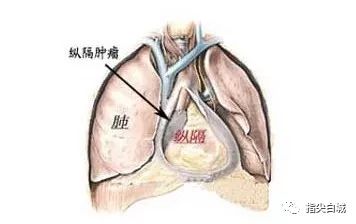 纵膈在我们人体这个位置