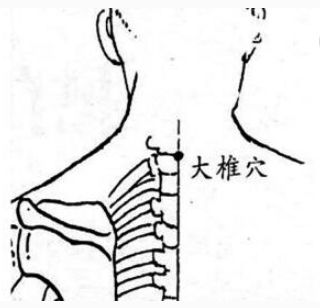 穴位| 快速振奋一身之阳气——大椎穴!