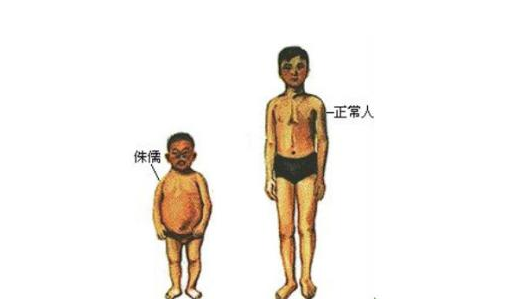 1.宝宝生来患有骨胳系统疾病如软骨营养不良和佝偻病