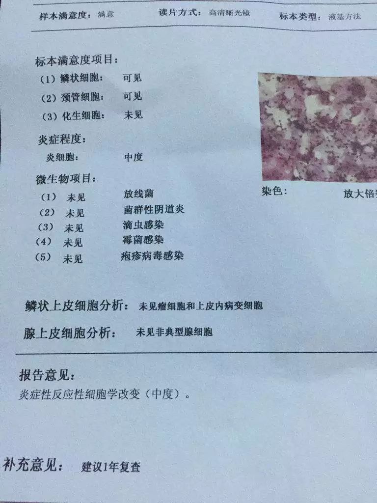 5tct检查报告:tct(宫颈液积细胞学检查)的目的跟宫颈刮片一样,比刮片