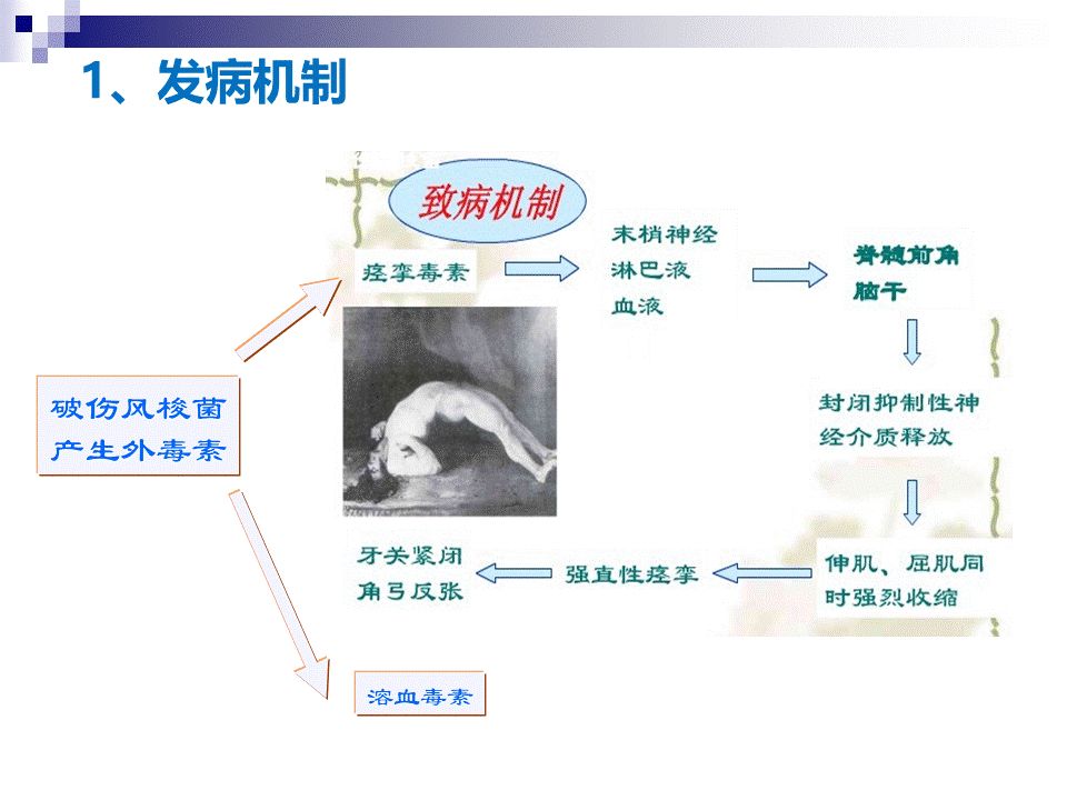 破伤风的诊断和防治课件