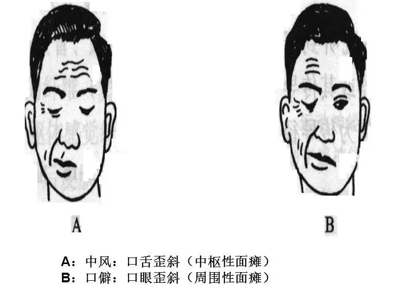 脸受风了怎么办