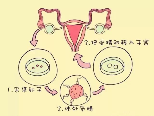 生男生女,双胞胎,试管婴儿能实现吗?