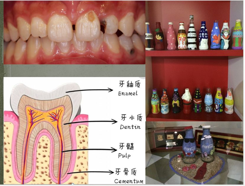 爸爸妈妈大讲堂可乐与牙齿