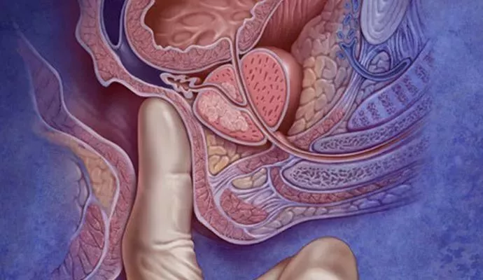 直肠指检在肛肠疾病诊治过程中具有十分重要的作用,多种肛门和直肠