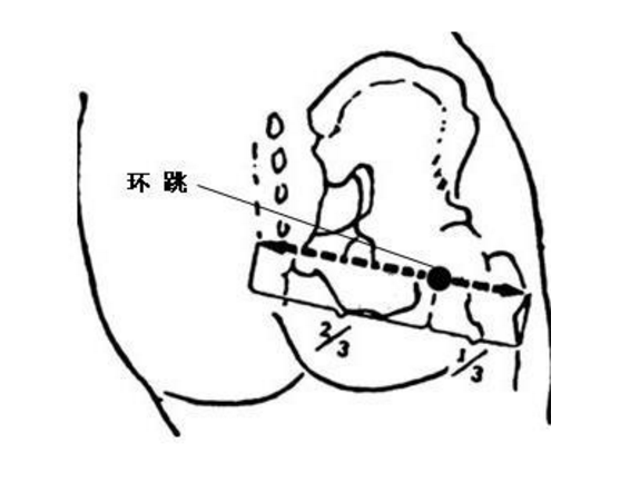 环跳穴的准确位置图主治:袪风除湿,强腰通经.