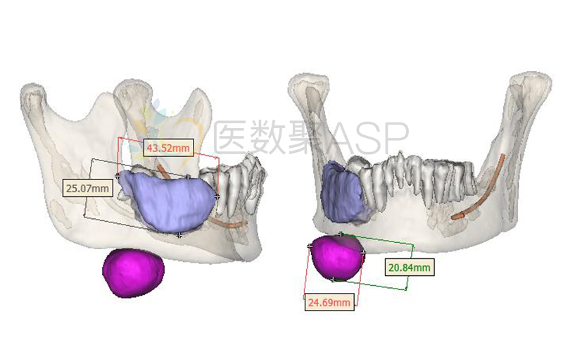 英乙第X輪：劍橋聯(lián)主場對陣巴恩斯利，誰將占據(jù)上風？