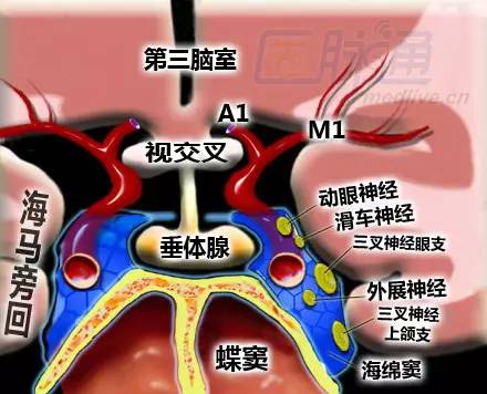 垂体层面冠状位示意图 医脉通编译自:robin smithuis.