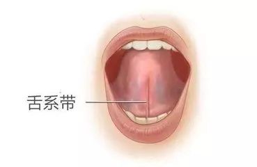 1,让宝宝舌头向前伸时,越过门齿小于2mm,或者呈现出w型或者心型,如下