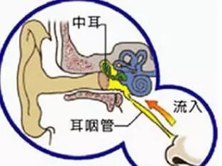 小孩中耳炎怎么办