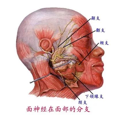 吃槟榔腮帮子变大了怎么办