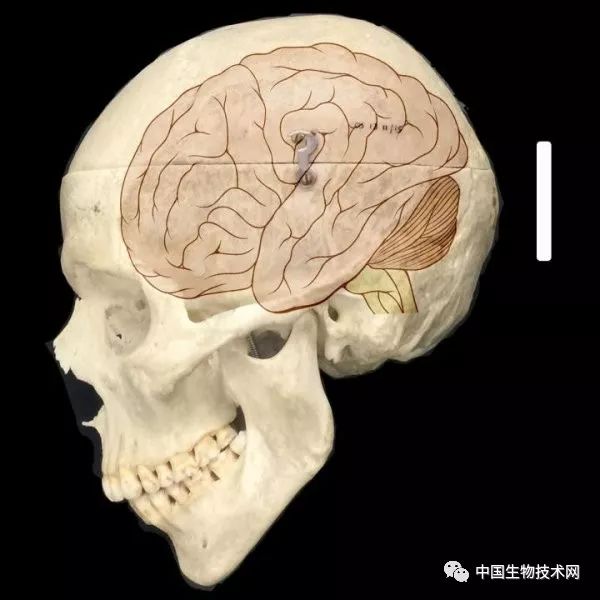 人类颅骨和大脑的示意图.图片来源:fiddes et al. / cell