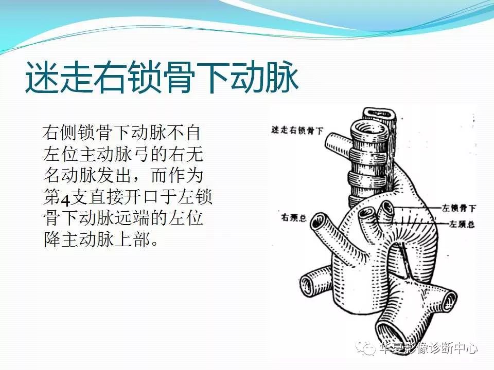 影像基础主动脉弓及其主支的先天畸形