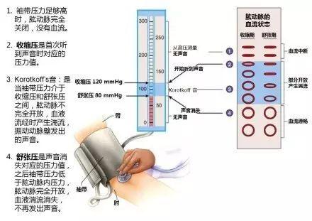 血压的原理_图2-10 血压的调节机制(3)