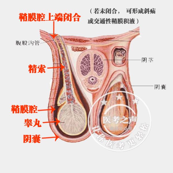 腹股沟解剖 和 腹股沟疝,学医这么多年终于搞懂了!