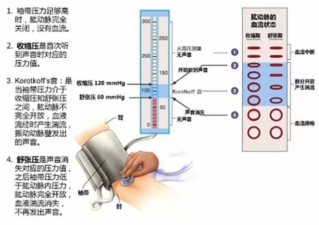 手机测血压是什么原理 准确吗_幸福是什么图片(2)