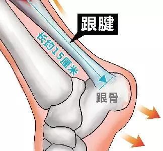 跟腱俗称脚筋,是足踝后部人体最强大的肌腱,跟腱断裂一般会出现提踵