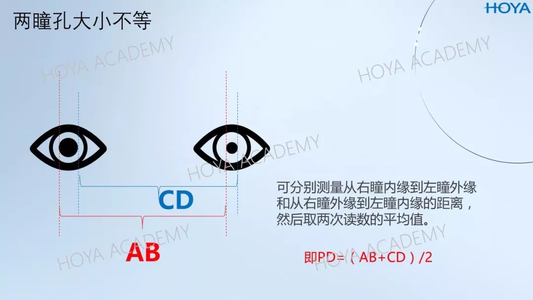 两瞳孔位置不对称斜视眼鼻梁歪斜的单眼瞳距测量一脸懵逼不要紧收藏