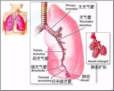 【收藏】医生必须掌握的肺部听诊技巧