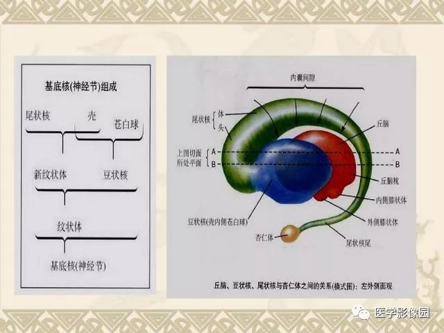 基底节对称性病变的病因和影像学特征 | 影像天地