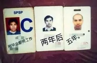 可怕!36岁it男被"鬼剃头,他的习惯很多厦门人都有,小心中招!