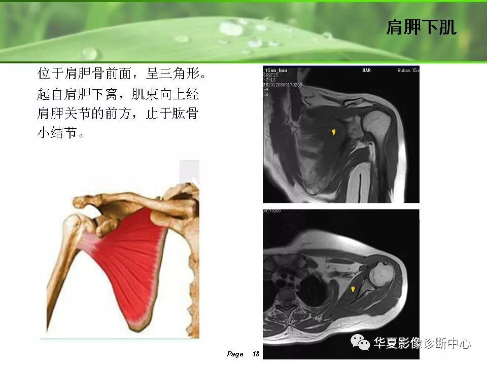 肩关节解剖及常见病变的mri诊断