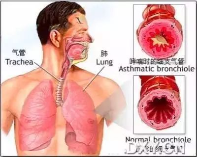 【收藏】医生必须掌握的肺部听诊技巧