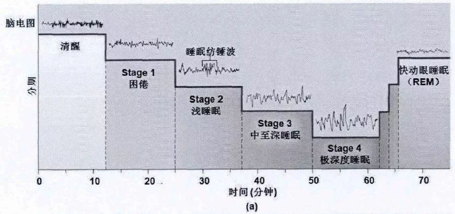 猝死凶竟是睡眠不足!重磅研究结果出炉,不说了我要去睡觉了!