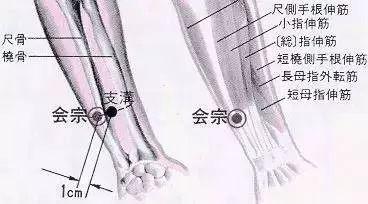 首页 湖湘杏林教育 相关资讯 会宗穴位置图和功效作用    腕背横纹上3