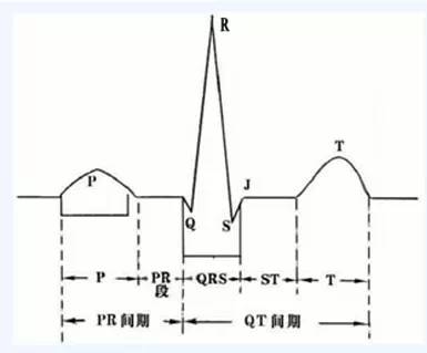 冠心病的心电图诊断
