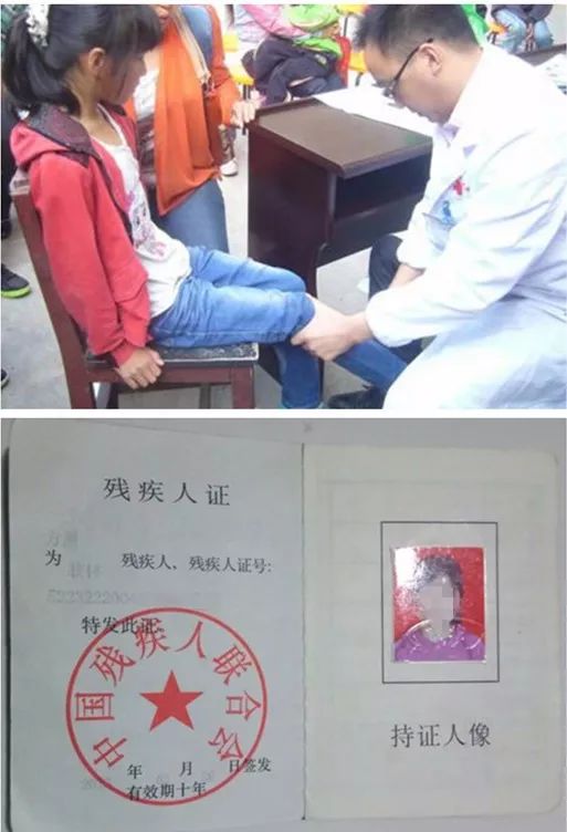 兴仁残疾青少年 女,汉族,生于2004年2月3日,肢体二级残疾,残疾证号