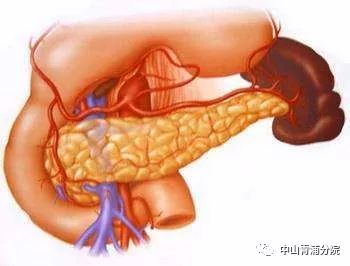 【健康】"酒肉"胰腺炎