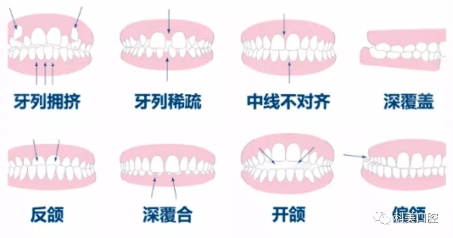 成人口呼吸多久可以改正_最后的呼吸sans