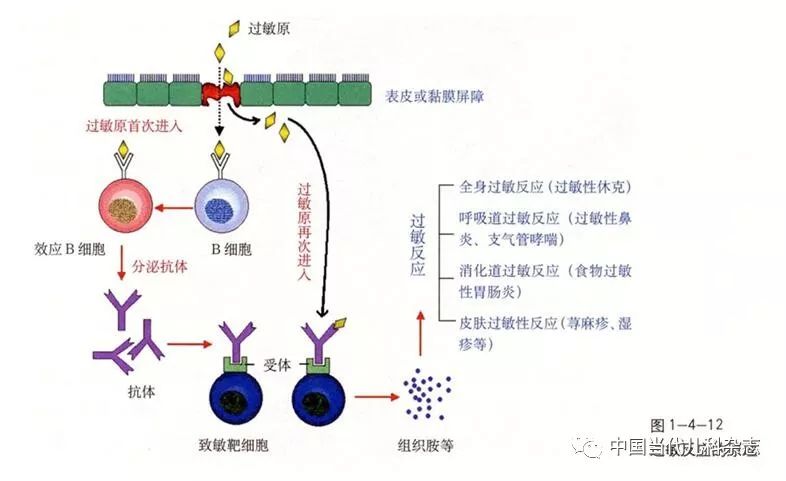 婴幼儿过敏性疾病的发病机制春夏交替,正值食物过敏,湿疹,特应性皮炎