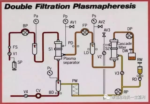 是指将病人体内病原体,也称致病因子,从血液中分离过滤出来,将净化后
