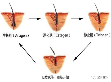 化疗脱发怎么办